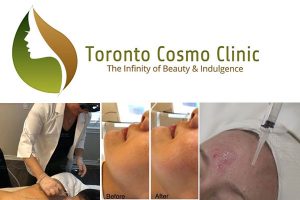 Toronto Cosmo Clinic