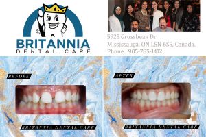 Britannia Dental Care Mississauga