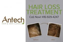 Antech Hair & Skin Clinic